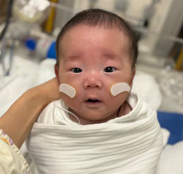 임신 23주 만에 체중 500g으로 태어나 171일간 신생아 중환자실에서 치료를 받으며 네 차례의 전신마취 수술을 이겨낸 이주하양. 주하양은 지난 8일 3.85㎏으로 건강하게 퇴원했다. /서울성모병원