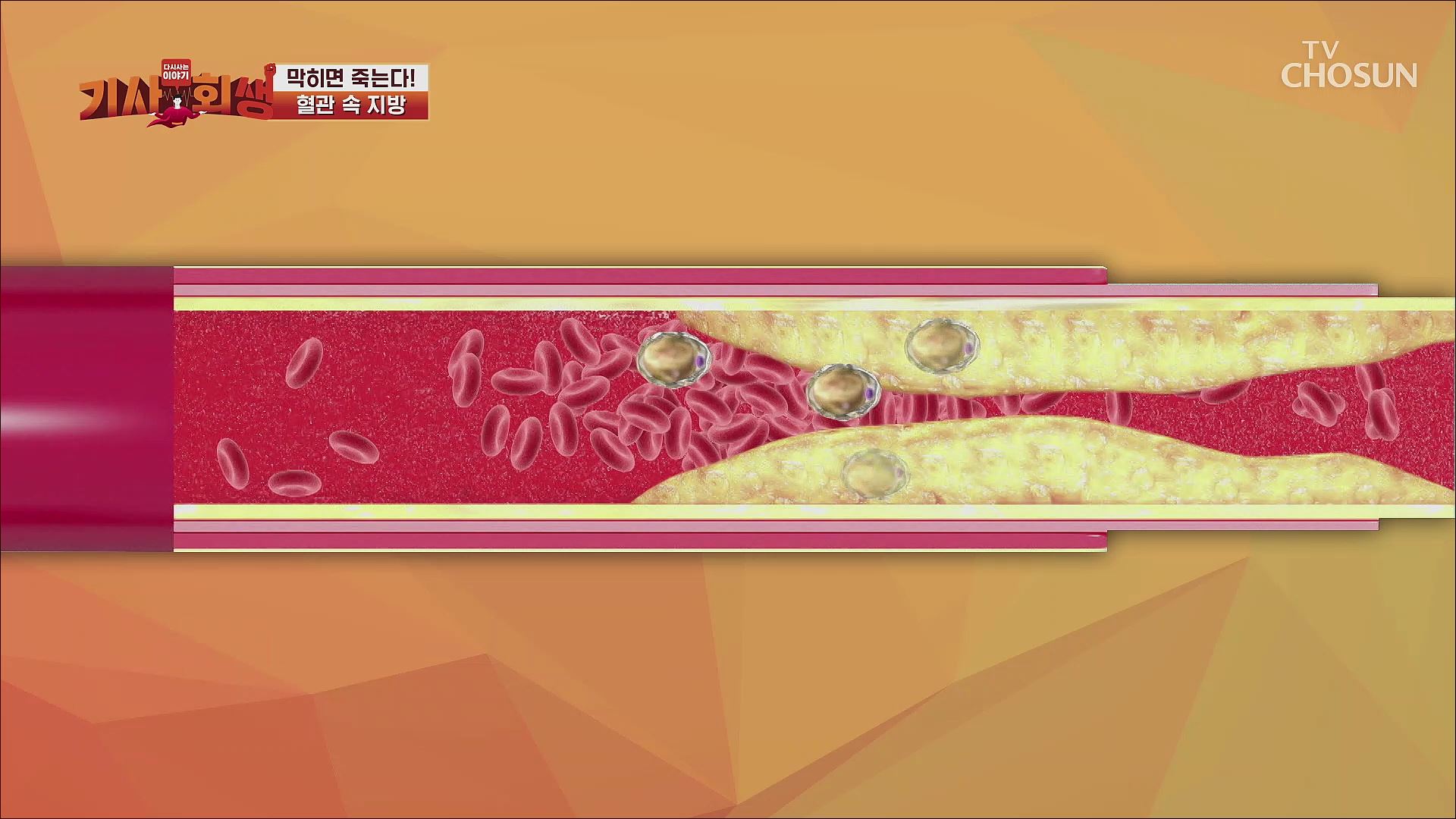 다시 사는 이야기 기사회생 1회