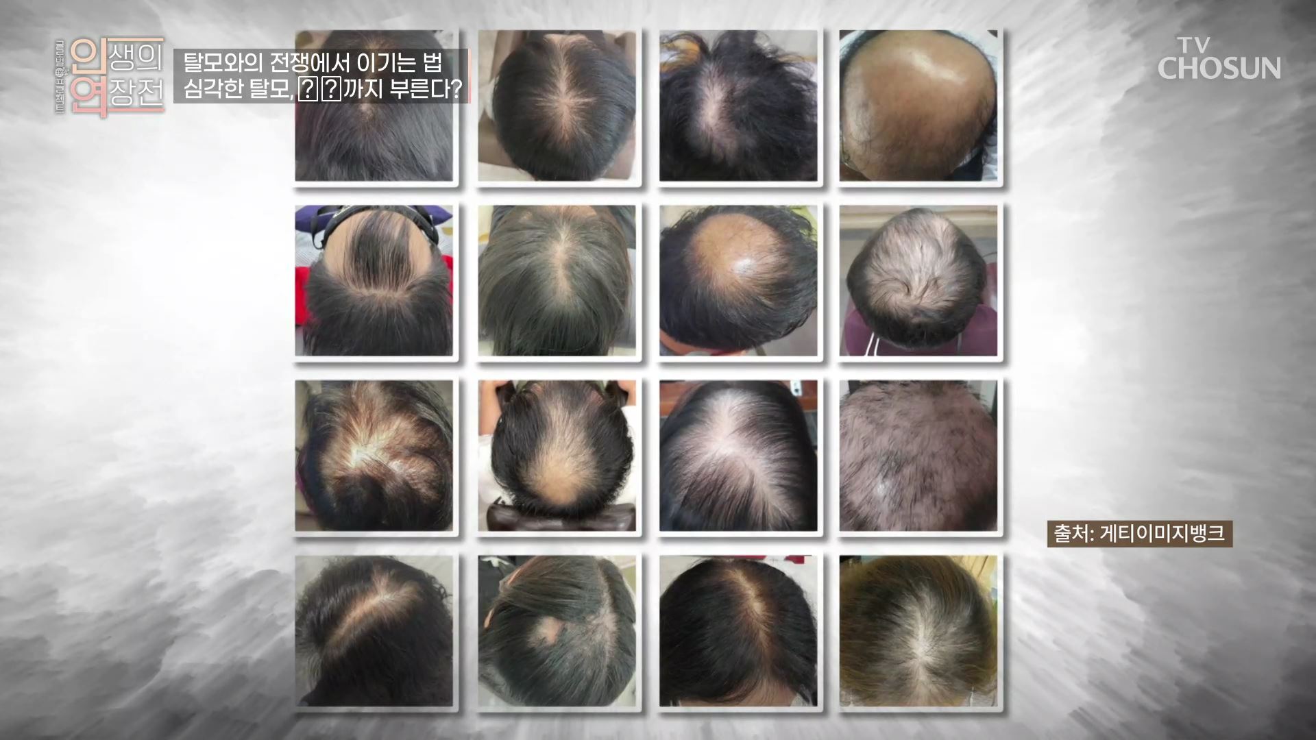 인생의 연장전 29회