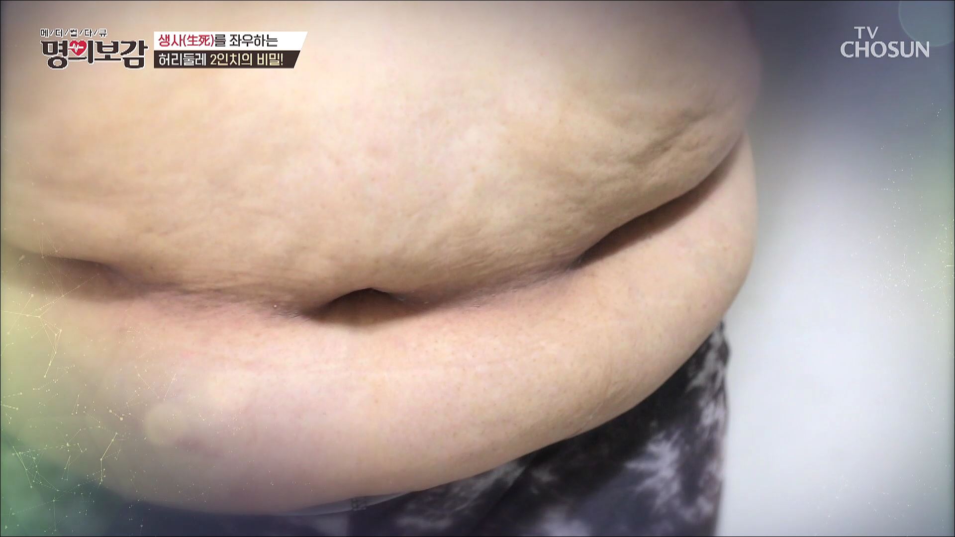 메디컬다큐 명의보감 4회