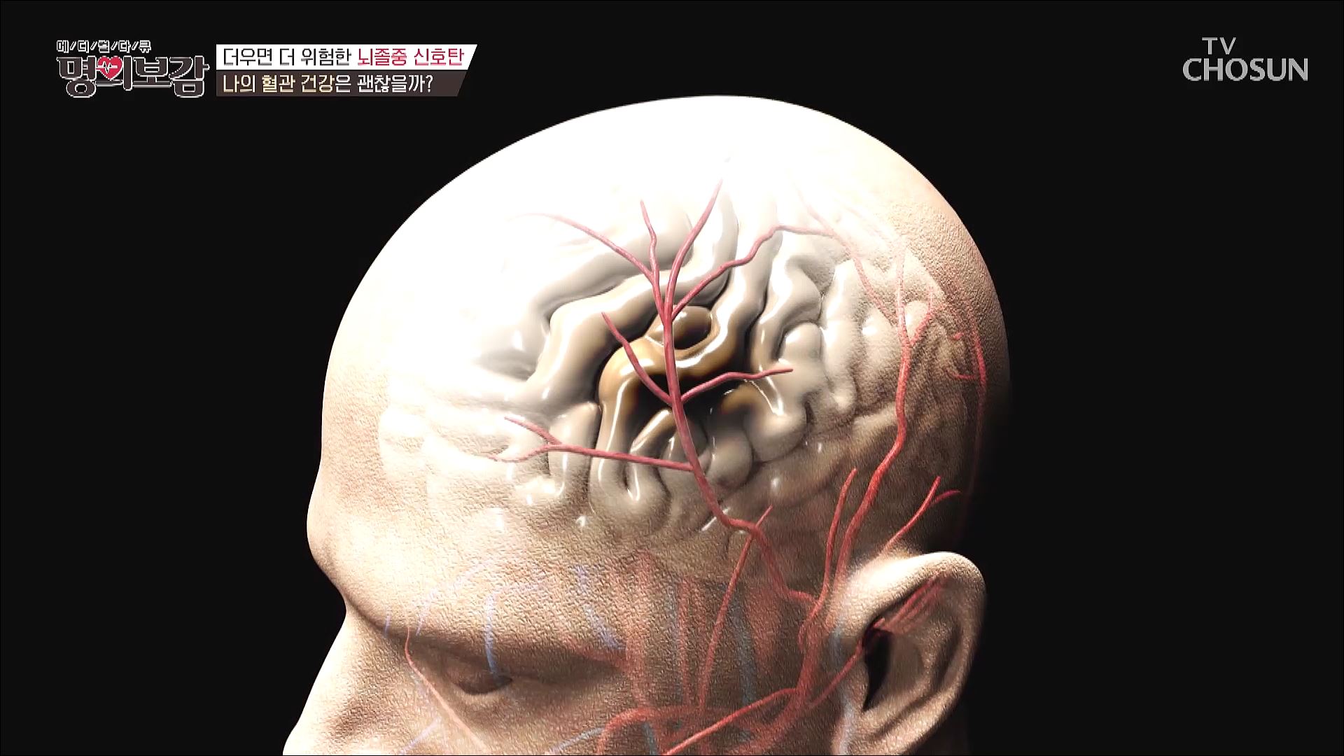 메디컬다큐 명의보감 5회