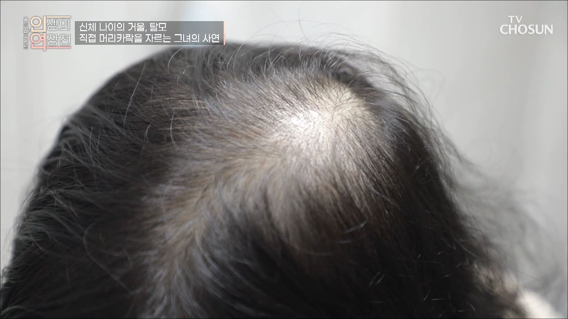 인생의 연장전 61회