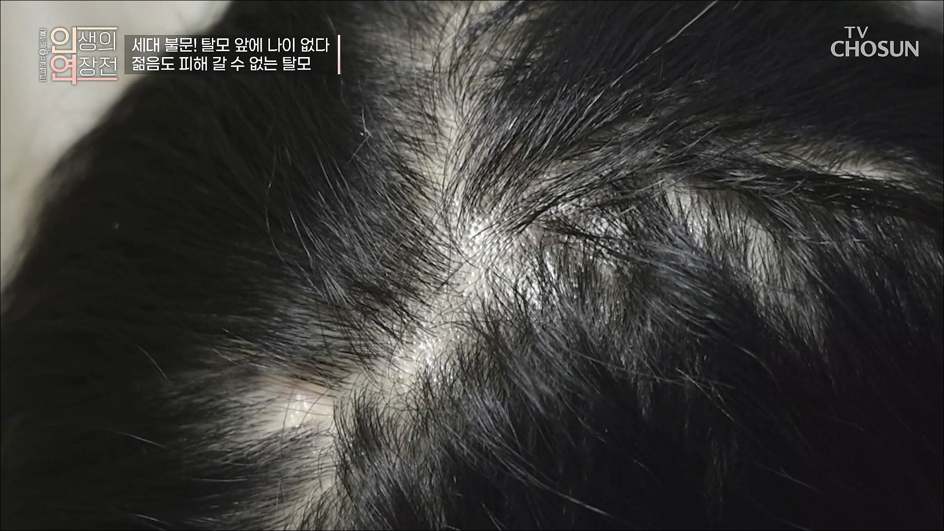 인생의 연장전 64회