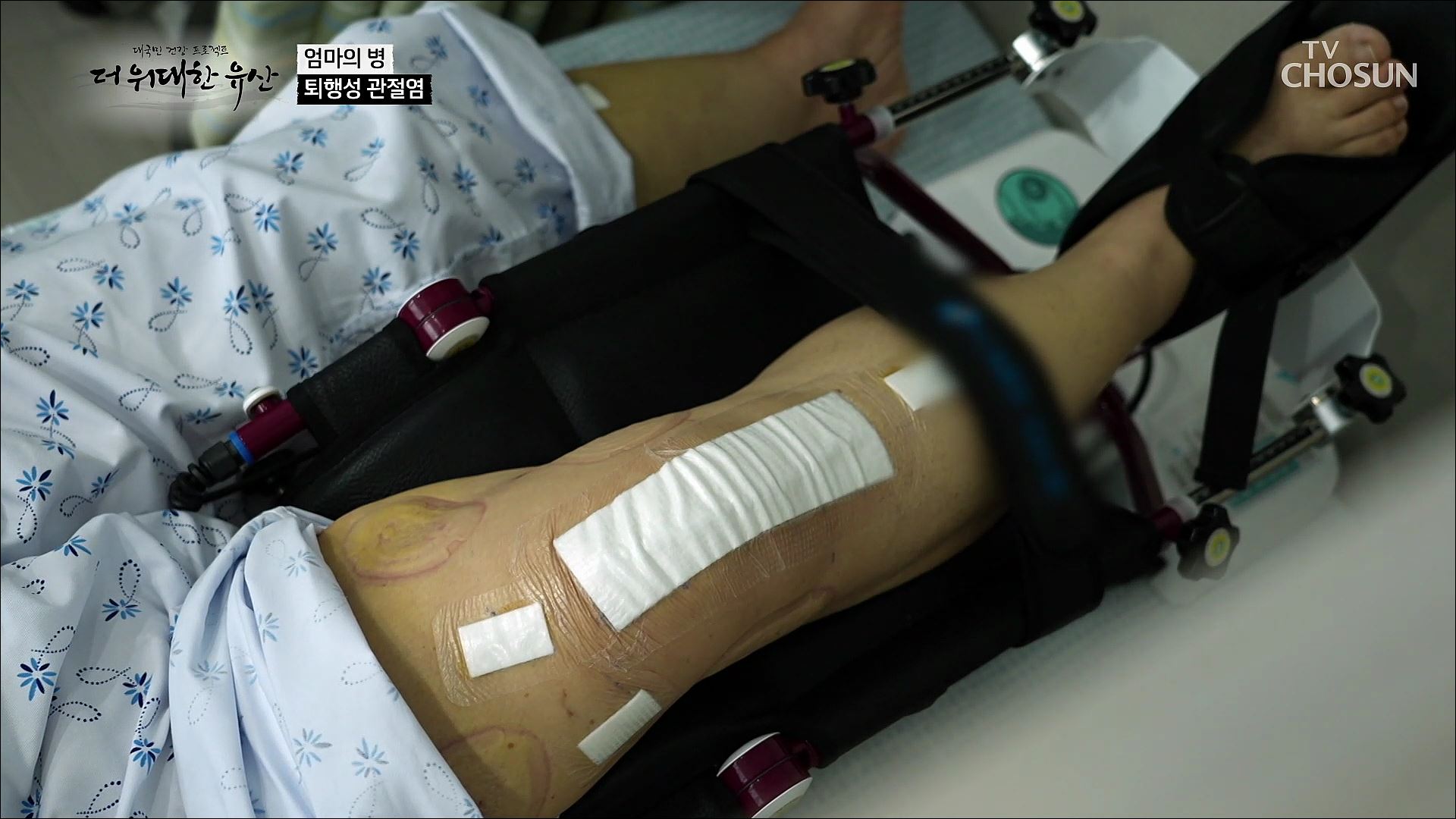 더 위대한 유산 101회